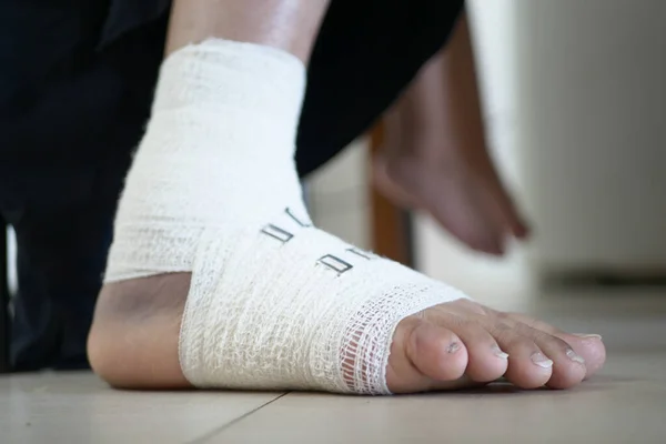 Ayakları Bandajlı Kadın Yakın Plan — Stok fotoğraf