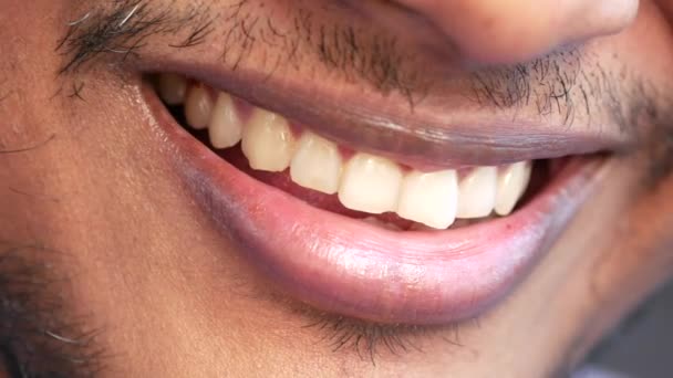 若い男オープンマウント彼の歯をチェック — ストック動画
