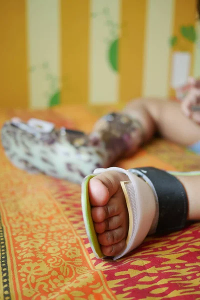 Ανικανότητα Στην Παιδική Εγκεφαλική Παράλυση Ορθώσεις Ποδιών — Φωτογραφία Αρχείου