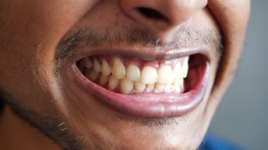 Genç adam dişlerini kontrol etmek için atlarını açıyor. .