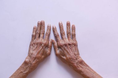 Yaşlı bir insanın ellerini kapat. ,