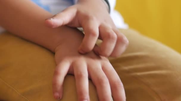 Gadis Anak Menderita Gatal Kulit Tangan — Stok Video