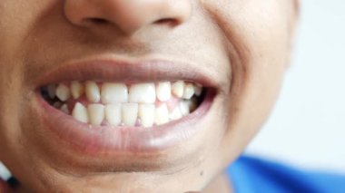 teenage boy smiling with healthy white teeth