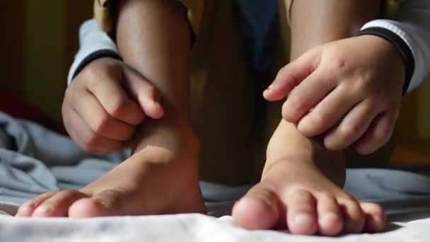 Gadis Kecil Yang Menderita Gatal Kulit Tutup — Stok Video