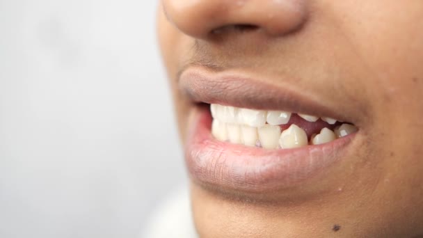 Teenage Boy Smiling Healthy White Teeth — Stock Video