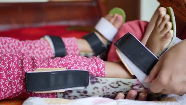 Kecacatan Cerebral Anak Kaki Orthosis — Stok Video