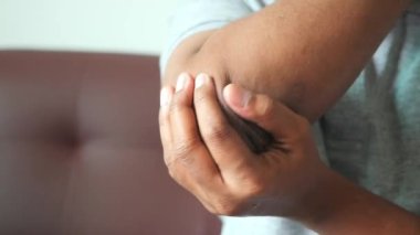 Dirsek ağrısı olan bir adam. Ağrı kesici kavramı