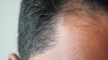 Saç dökülmesi konsepti. .