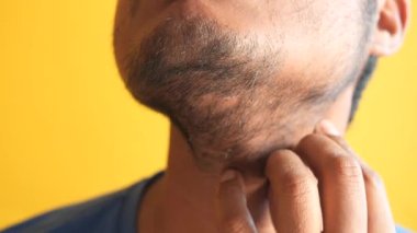 Yüzünde kaşıntı olan bir adam .