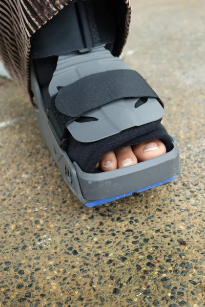 women broken feet with a grey plastic boot ankle brace injury protecting boot,