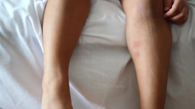  Kaşınan deriden muzdarip kız çocuğu, yakından bak...