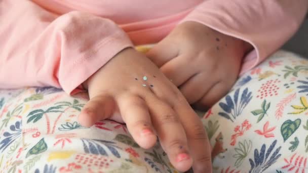 Gadis Kecil Yang Menderita Gatal Kulit Tutup — Stok Video