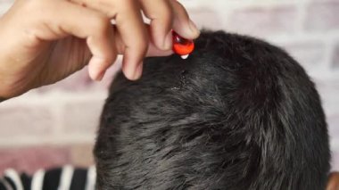 Erkekler saçlarına kapsül yağı sürüyor. .