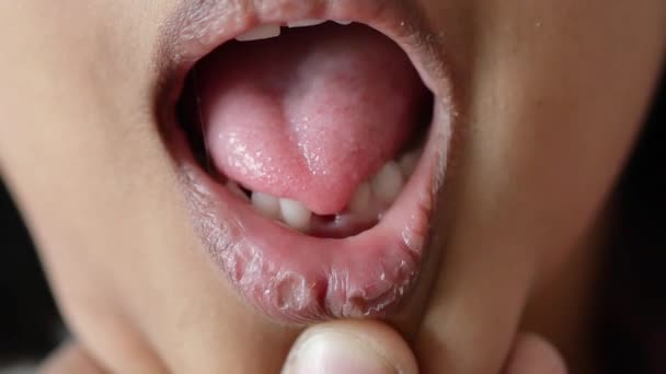 Detail Schot Van Het Kind Met Ontbrekende Tanden — Stockvideo