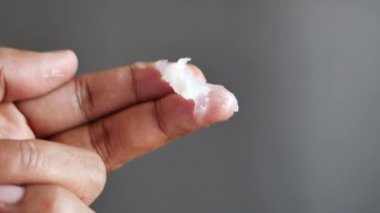 Yağ jölesi kullanarak insan elini kapat. .