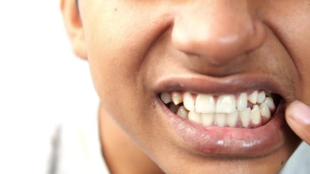 Έφηβος Αγόρι Ευαίσθητα Δόντια — Αρχείο Βίντεο