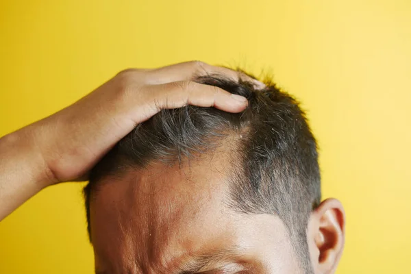 stock image hair loss concept with man checking his hair .