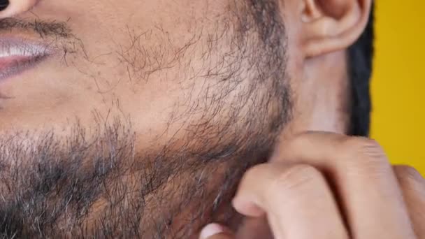 Homem Sofrendo Coceira Pele Seu Rosto — Vídeo de Stock