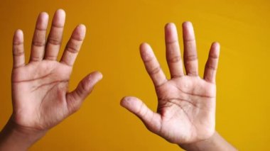 Kuru, çatlak bir erkek eli derisine yakın. ,