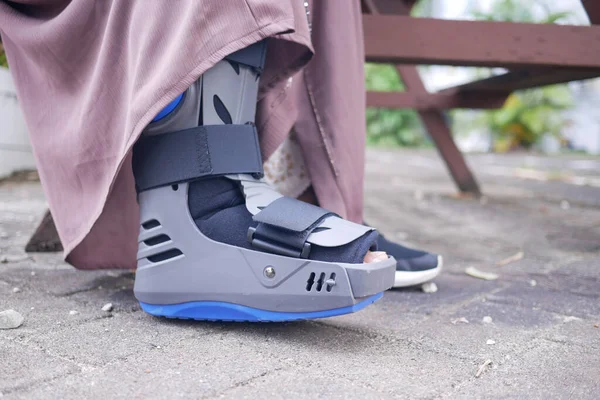 Γυναίκες Σπασμένα Πόδια Γκρι Πλαστική Μπότα Αστράγαλο Στήριγμα Τραυματισμό Προστασία — Φωτογραφία Αρχείου