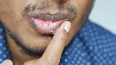  Dudağına yağ jölesi süren genç adama yaklaş..