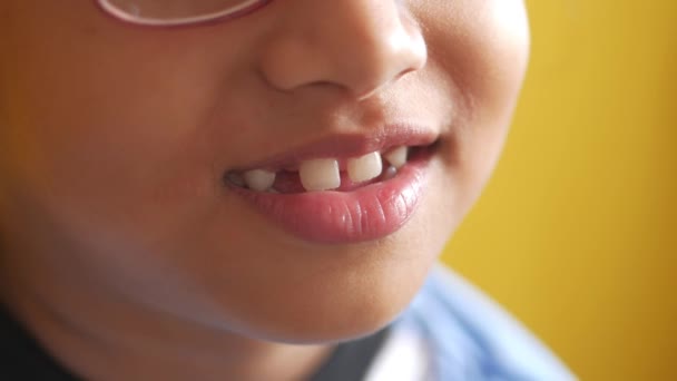 Παιδί Χαμογελά Δόντια Λείπουν — Αρχείο Βίντεο