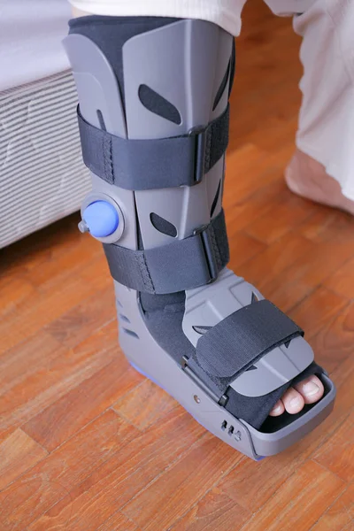 Жінки Зламані Ноги Сірим Пластиковим Черевиком Щиколотки Захищаючи Черевик — стокове фото