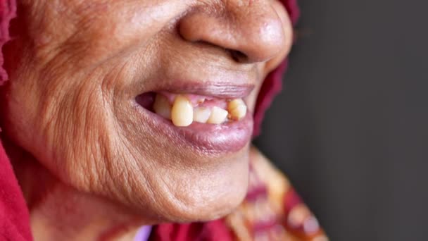 Close Senior Womens Dental Caries Some Broken Teeth — Stock Video