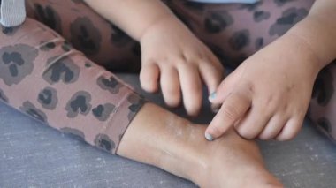  Kaşınan deriden muzdarip kız çocuğu, yakından bak...