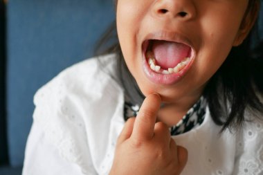 Dişleri eksik çocuğun detaylı görüntüsü..