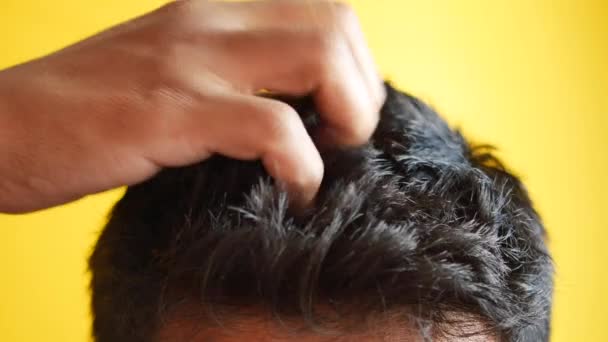 Laki Laki Dengan Ketombe Rambutnya Closeup — Stok Video