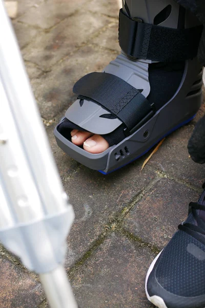 Жінки Зламані Ноги Сірим Пластиковим Черевиком Щиколотки Захищаючи Черевик — стокове фото