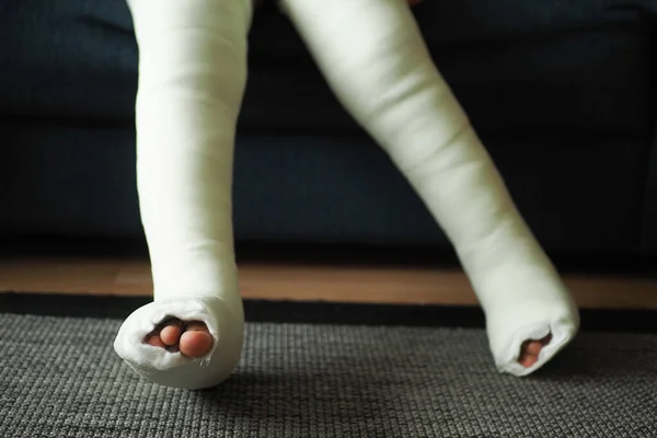 足に石膏の包帯をした小さな子供の男の子 — ストック写真