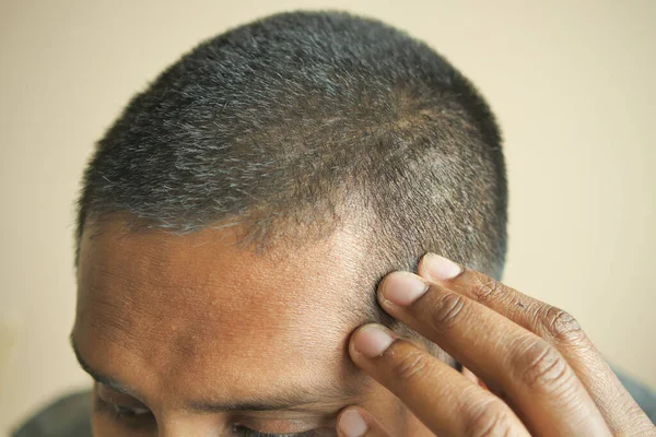 Koncepcja Wypadania Włosów Człowiekiem Sprawdzanie Jego Włosy — Zdjęcie stockowe