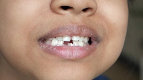 Tiro Detalhe Criança Com Dentes Ausentes — Vídeo de Stock