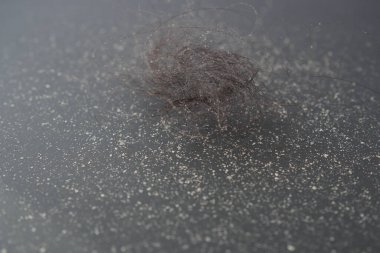  Siyah arka planda kepek ve saçlar .