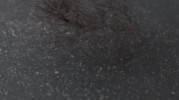 Dandruff Hairs White Background — Wideo stockowe