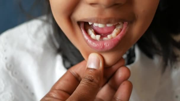 Ujęcie Dziecka Brakującymi Zębami — Wideo stockowe