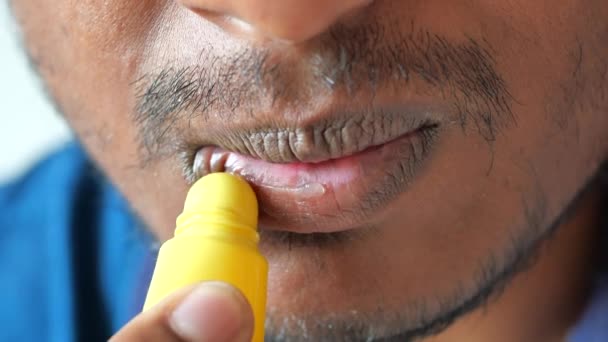 Hombre Joven Aplicando Bálsamo Labial Hidratante Los Labios — Vídeo de stock