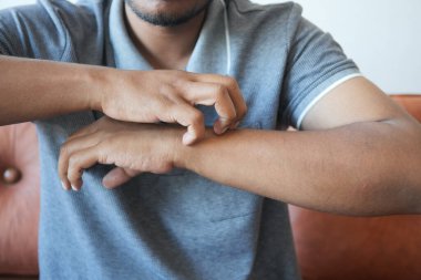 Kaşındıran deriden muzdarip bir adam. Yaklaş.