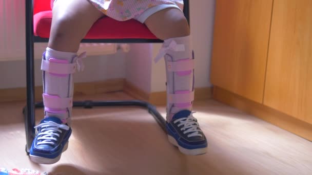 小児脳性麻痺障害 足の矯正 — ストック動画