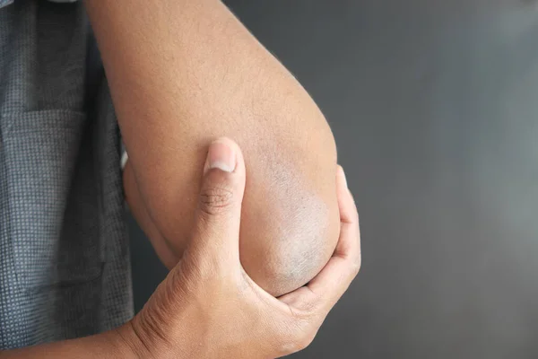 man with elbow pain. Pain relief concept
