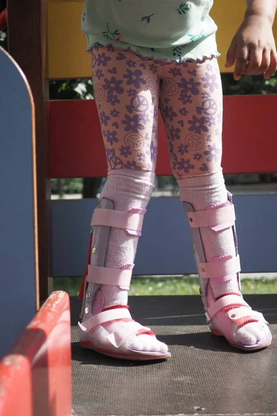 Çocuk serebral felç, bacak ortozu.