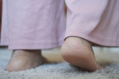 Kadın bacakları, evdeki el arabasında yalın ayak yürür. 