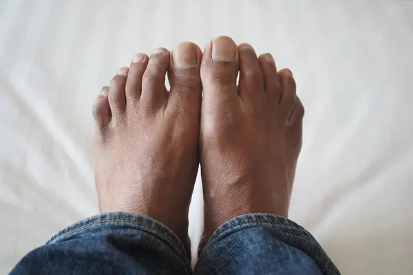 close up of young men dry feet on bed .