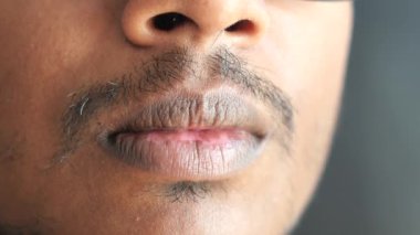 Genç bir adama yaklaş. Dudakları kuru. .