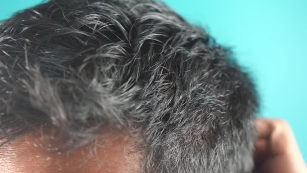 Άνδρες Ξύνοντας Κεφάλι Του Closeup — Αρχείο Βίντεο