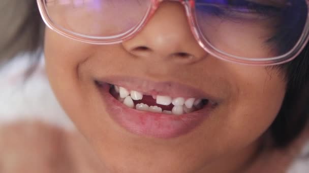 牙齿缺失儿童的详细照片 — 图库视频影像