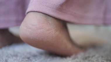 Kadın bacakları, evdeki el arabasında yalın ayak yürür. 