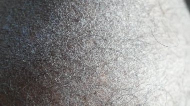 Kuru insan derisinin yakın görüntüsü